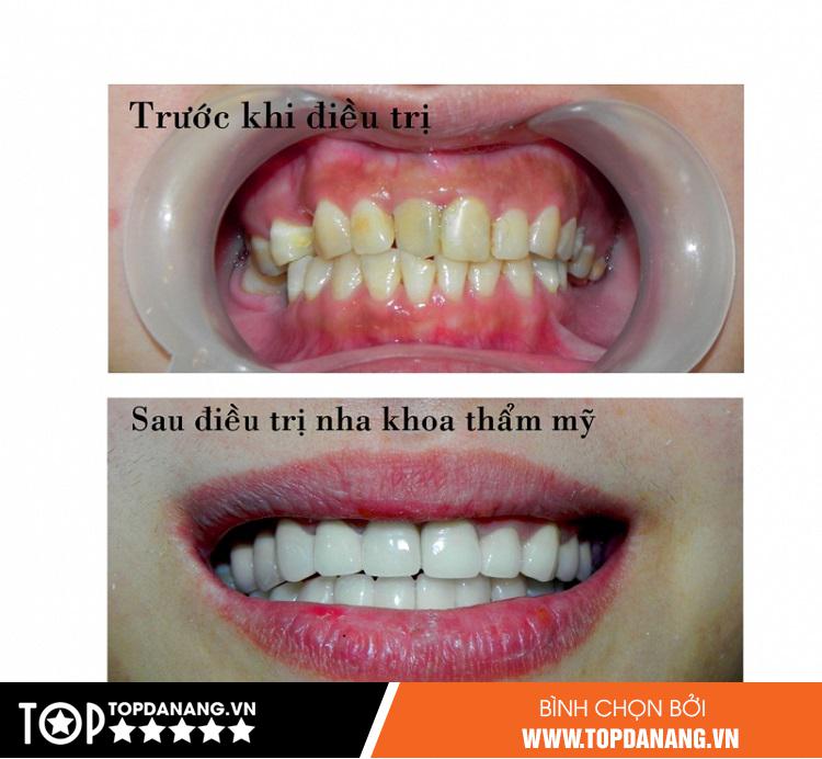 Nha khoa Việt Khương – Phòng khám nha khoa Đà Nẵng